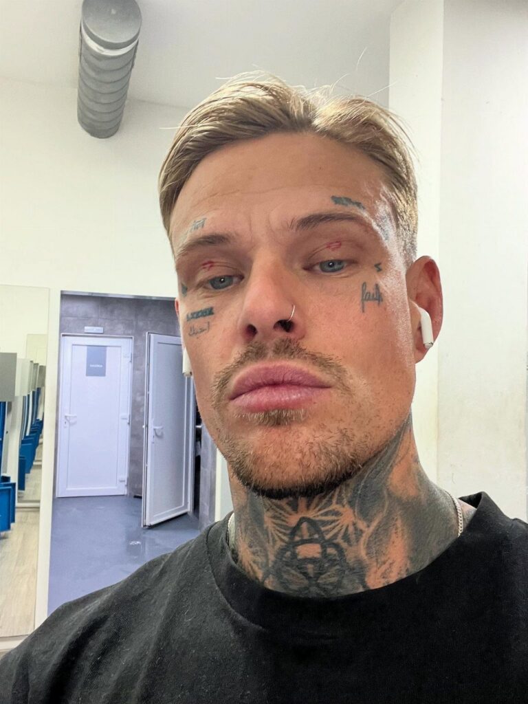 Man with black ink tattoos on his face and neck wearing a black shirt